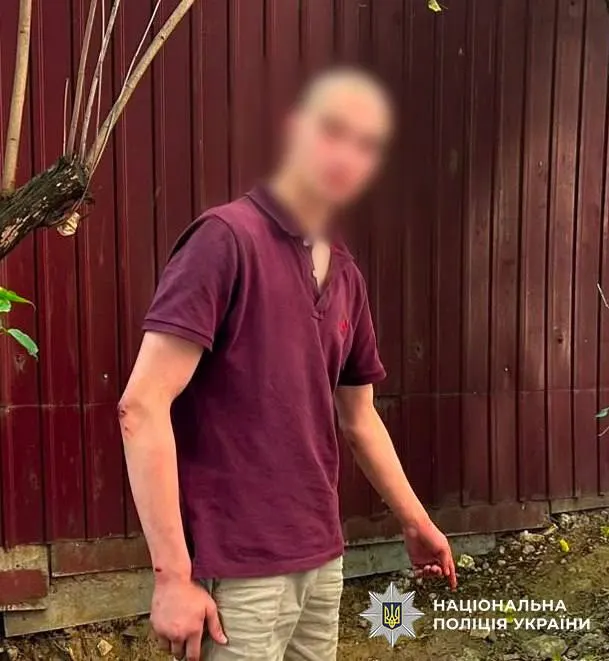 У Голосієві хлопець запускав ракети, щоб вразити дівчат — йому загрожує покарання