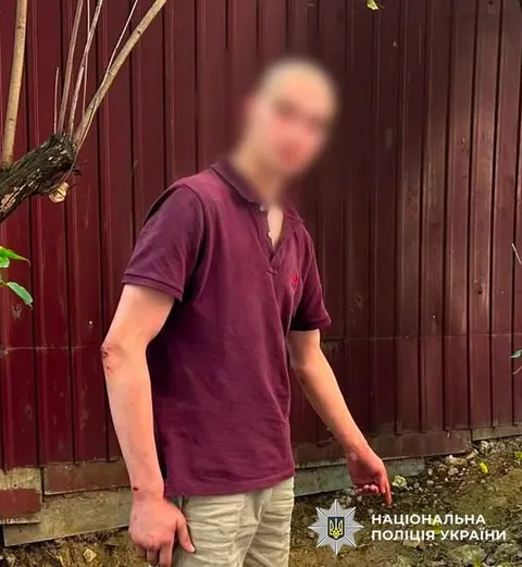 У Голосієві хлопець запускав ракети, щоб вразити дівчат — йому загрожує покаранн