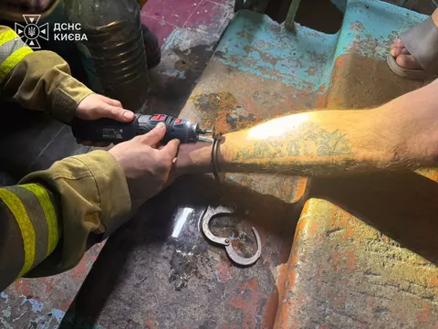 У Києві рятувальники серед ночі знімали кайданки з ноги чоловіка
