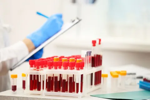 Через дорогу до роботи київські лікарні можуть втратити медсестер