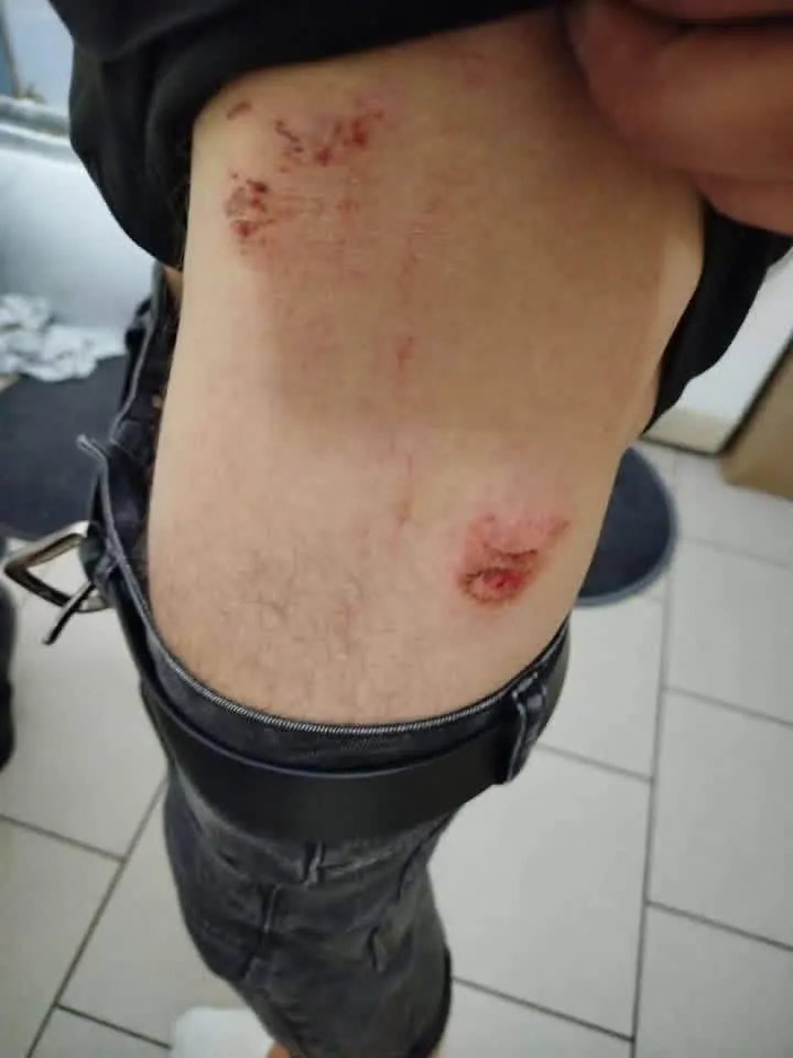 У Польщі після конфлікту через гучну музику постраждали троє українців