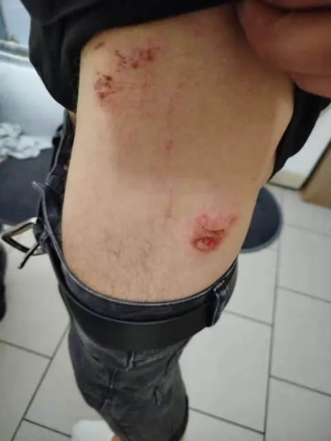 У Польщі після конфлікту через гучну музику постраждали троє українців